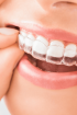 Ortodontia - Unique Dental Care