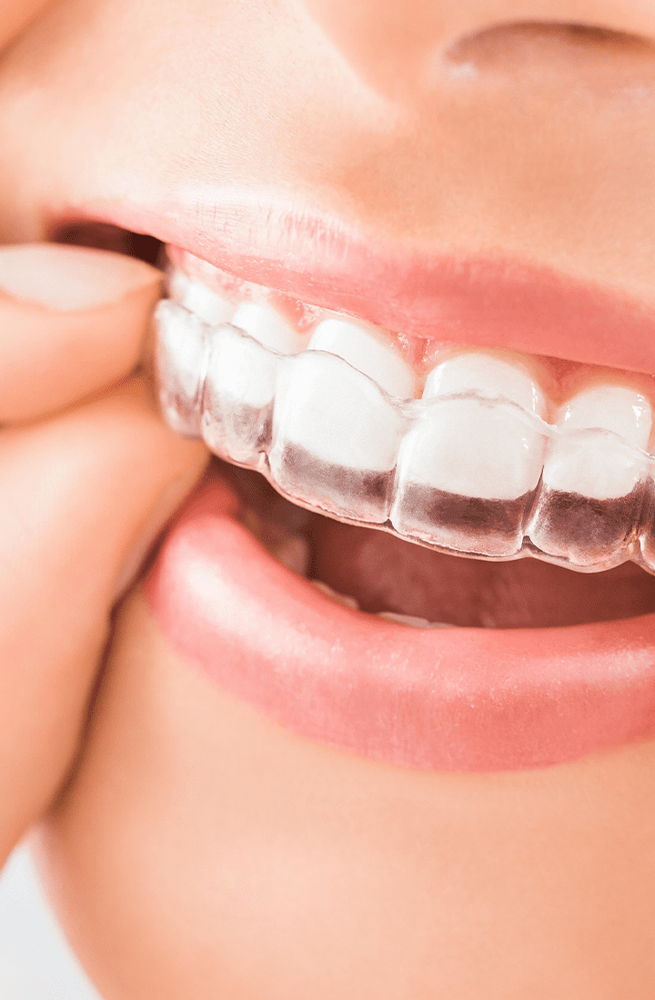 Ortodontia - Unique Dental Care