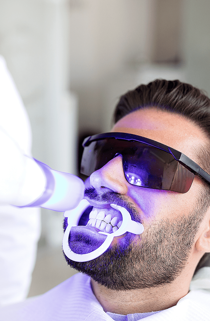 Branqueamento - Unique Dental Care
