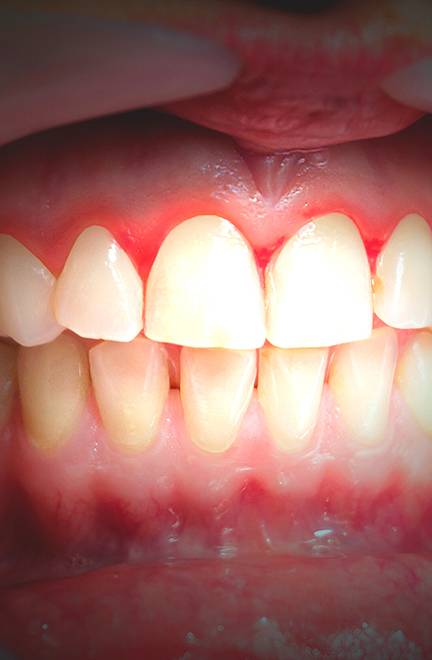 periodontolodia1